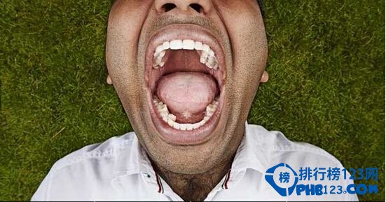世界上有最多牙齿的人 牙齿多达三十多颗